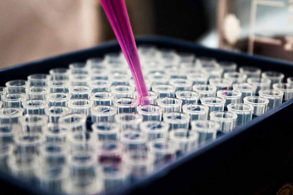 Pipetting liquid into tubes. Photo: Louis Reed / Unsplash